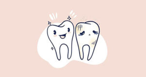 A graphic of two teeth, one after teeth whitening, and one before.