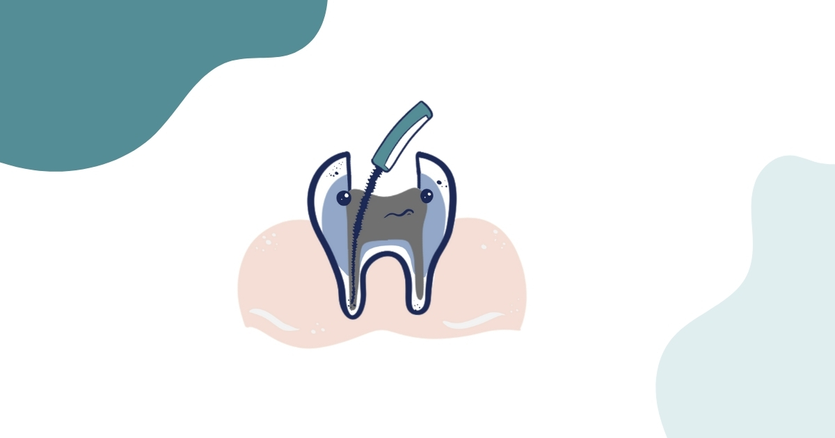 The procedure of root canals