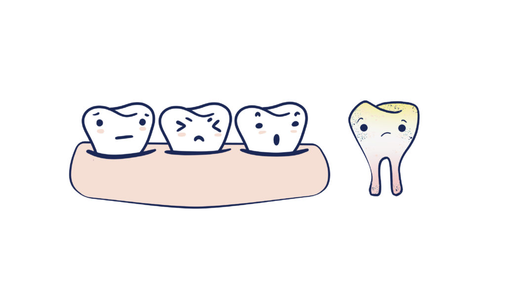 three hurt illustrated teeth in gums with one upset, stained tooth