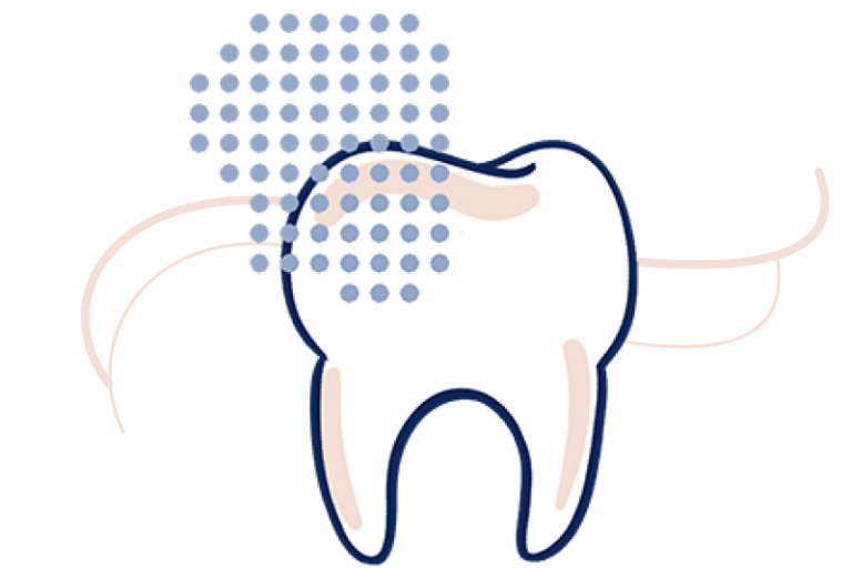 Illustration of a tooth surrounded by dots and lines to represent an intraoral scanner at work