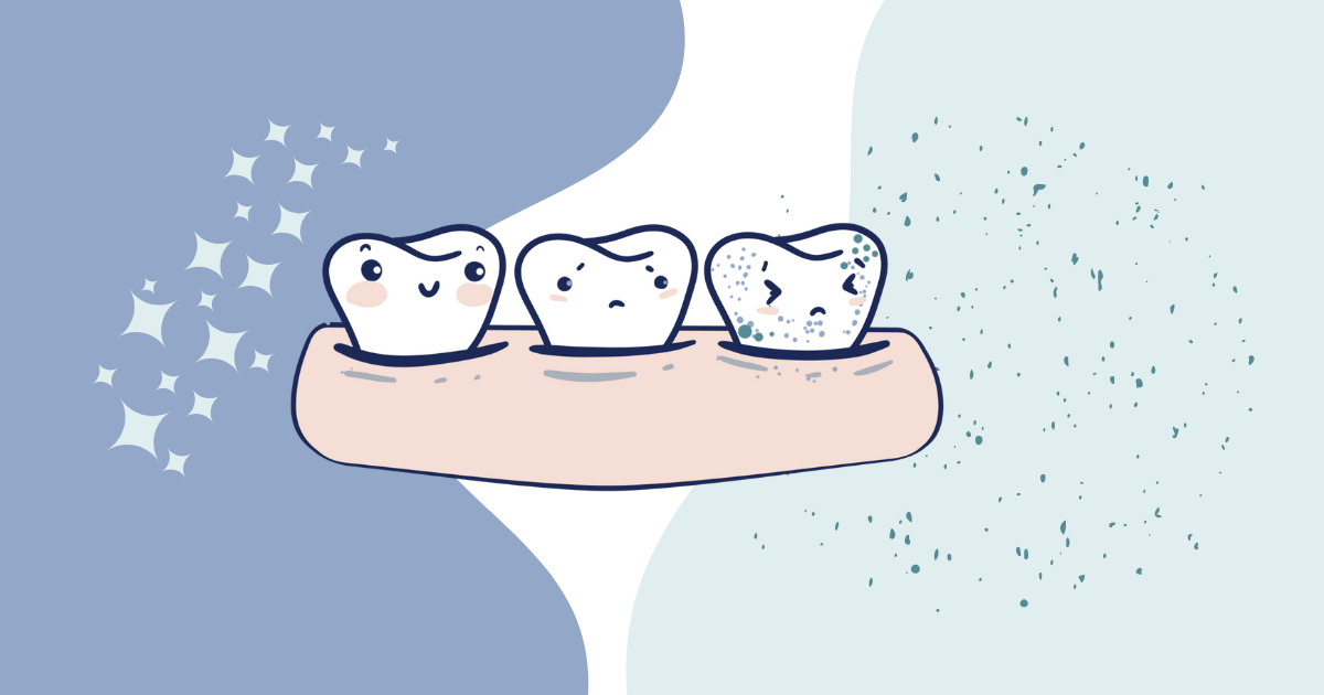 Illustration of three teeth showing different levels of oral hygiene