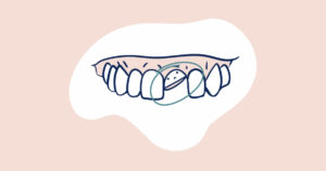 A minimalist illustration of a smile showing teeth, with one tooth circled to highlight a dental issue. This image represents the need of a smile makeover, focusing on dental corrections and cosmetic improvements.