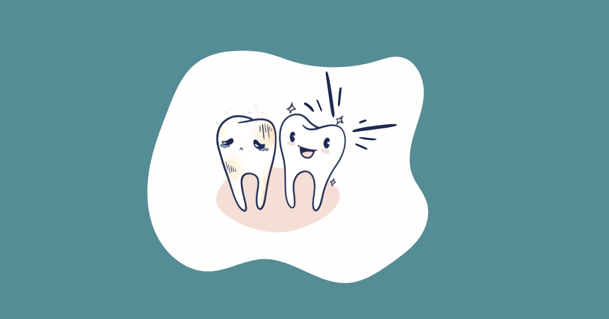 Cartoon of a sad, damaged tooth beside a happy, sparkling tooth, representing the emotional and physical impact of tooth avulsion and tooth loss, and the role of restorative dentistry in recovery.